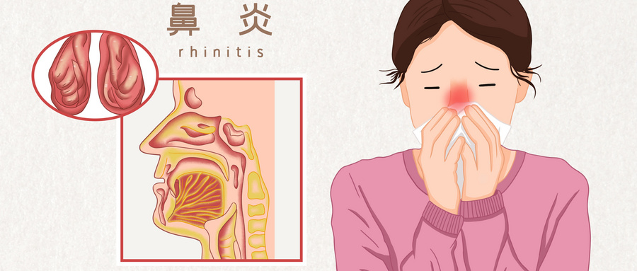 让鼻子通气的最快方法是什么？为什么晚上一躺下就鼻塞白天没事